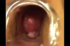 Wife speculum in pussy with jizz